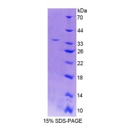 SDS-PAGE analysis of recombinant Rat CES1 Protein.