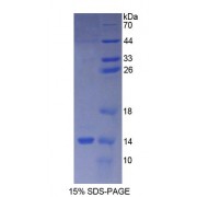 SDS-PAGE analysis of Human CGb1 Protein.