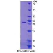 SDS-PAGE analysis of Human CHODL Protein.