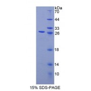 SDS-PAGE analysis of Human CHP Protein.