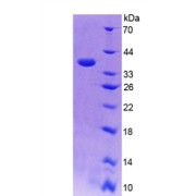 SDS-PAGE analysis of Human CISH Protein.