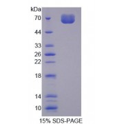 SDS-PAGE analysis of Mouse CKAP2 Protein.