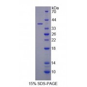 SDS-PAGE analysis of recombinant Human COX6c Protein.