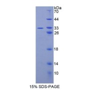SDS-PAGE analysis of Human CPEB1 Protein.