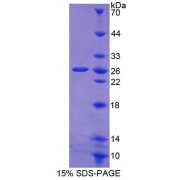 SDS-PAGE analysis of Human CORT Protein.