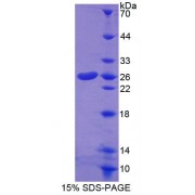 SDS-PAGE analysis of Mouse CORT Protein.