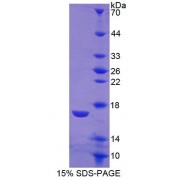 SDS-PAGE analysis of Rat CTR Protein.