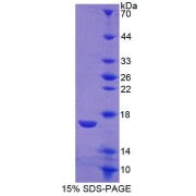 SDS-PAGE analysis of Rat CTR Protein.