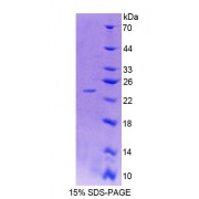 SDS-PAGE analysis of Rat CHN2 Protein.