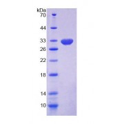 SDS-PAGE analysis of Human DAAM1 Protein.