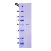 SDS-PAGE analysis of Human DPPA3 Protein.
