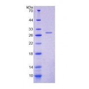 SDS-PAGE analysis of Rat DOK1 Protein.
