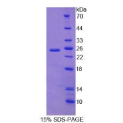 SDS-PAGE analysis of Mouse DTNBP1 Protein.