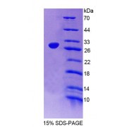 SDS-PAGE analysis of Mouse DKC Protein.