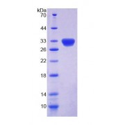 SDS-PAGE analysis of Rat DKC Protein.