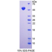 SDS-PAGE analysis of Mouse DAG1 Protein.