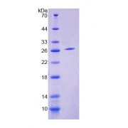 SDS-PAGE analysis of Human COVA1 Protein.