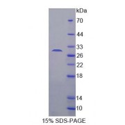 SDS-PAGE analysis of Mouse C/EBP delta Protein.
