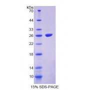 SDS-PAGE analysis of Human FASTK Protein.