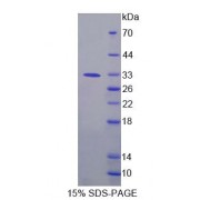 SDS-PAGE analysis of Human FPGT Protein.