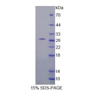 SDS-PAGE analysis of Mouse FVT1 Protein.