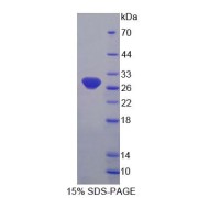 SDS-PAGE analysis of Human FBL Protein.