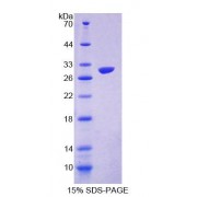 SDS-PAGE analysis of Mouse GAMT Protein.