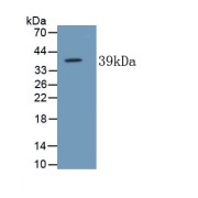 abx171157