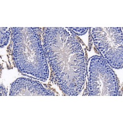 Alpha-1-Antitrypsin (SERPINA1) Antibody