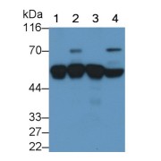 Western blot analysis of (1) Rat Liver lysate, (2) Rat Lung lysate, (3) Rat Testis lysate, (4) Rat Pancreas lysate, using Mouse Anti-Rat a1AT Antibody (0.2 µg/ml) and HRP-conjugated Goat Anti-Mouse antibody (<a href="https://www.abbexa.com/index.php?route=product/search&amp;search=abx400001" target="_blank">abx400001</a>, 0.2 µg/ml).