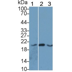 Angiopoietin-Related Protein 8 (ANGPTL8) Antibody