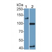 WB analysis of Lane 1: Pig kidney lysate and Lane 2: Mouse kidney lysate, using ACE2 Antibody (0.6 µg/ml).