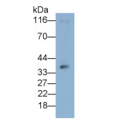 Western blot analysis of Jurkat cell lysate, using Mouse Anti-Human CD86 Antibody (0.6 µg/ml) and HRP-conjugated Goat Anti-Mouse antibody (<a href="https://www.abbexa.com/index.php?route=product/search&amp;search=abx400001" target="_blank">abx400001</a>, 0.2 µg/ml).