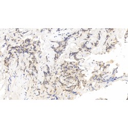 Forkhead Box Protein P3 (FOXP3) Antibody