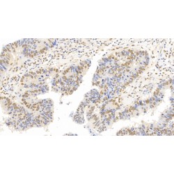 Forkhead Box Protein P3 (FOXP3) Antibody