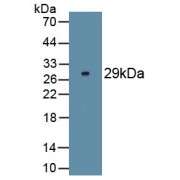 Western blot analysis of recombinant Human FOXP3.