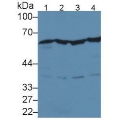 Forkhead Box Protein P3 (FOXP3) Antibody