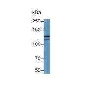 Western blot analysis of K562 cell lysate, using Mouse Anti-Human GRIN2D Antibody (0.2 µg/ml) and HRP-conjugated Goat Anti-Mouse antibody (<a href="https://www.abbexa.com/index.php?route=product/search&amp;search=abx400001" target="_blank">abx400001</a>, 0.2 µg/ml).
