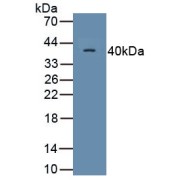 Western blot analysis of recombinant Human CD9/MRP1 Protein (with N-terminal His and GST tags).