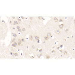 Nerve Growth Factor (NGF) Antibody