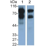 Western blot analysis of (1) Rat Heart lysate, and (2) Rat Cerebrum lysate, using Rabbit Anti-Human NEXN Antibody (0.2 µg/ml) and HRP-conjugated Goat Anti-Mouse antibody (<a href="https://www.abbexa.com/index.php?route=product/search&amp;search=abx400001" target="_blank">abx400001</a>, 0.2 µg/ml).
