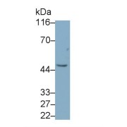 abx173977