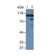 Western blot analysis of (1) Rat Serum, (2) Rat Plasma, using Mouse Anti-Rat Plg Antibody (0.2 µg/ml) and HRP-conjugated Goat Anti-Mouse antibody (<a href="https://www.abbexa.com/index.php?route=product/search&amp;search=abx400001" target="_blank">abx400001</a>, 0.2 µg/ml).
