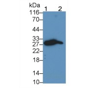 Western blot analysis of (1) Rat Spleen lysate, and (2) Rat Thymus lysate, using Mouse Anti-Human PDCD1 Antibody (0.2 µg/ml) and HRP-conjugated Goat Anti-Mouse antibody (<a href="https://www.abbexa.com/index.php?route=product/search&amp;search=abx400001" target="_blank">abx400001</a>, 0.2 µg/ml).