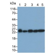 Western blot analysis of (1) Pig Testis lysate, (2) A549 cell lysate, (3) HepG2 cell lysate, (4) K562 cell lysate, and (5) PC3 cell lysate, using Mouse Anti-Human PSMD10 Antibody (0.5 µg/ml) and HRP-conjugated Goat Anti-Mouse antibody (<a href="https://www.abbexa.com/index.php?route=product/search&amp;search=abx400001" target="_blank">abx400001</a>, 0.2 µg/ml).