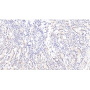 abx174335