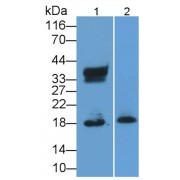 Western blot analysis of (1) Human Urine, and (2) Human Leukocyte lysate, using Mouse Anti-Human RNASE2 Antibody (2 µg/ml) and HRP-conjugated Goat Anti-Mouse antibody (<a href="https://www.abbexa.com/index.php?route=product/search&amp;search=abx400001" target="_blank">abx400001</a>, 0.2 µg/ml).