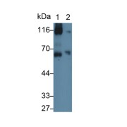 Western blot analysis of (1) Rat Spleen lysate, (2) Rat Cerebrum lysate, using Mouse Anti-Rat VCAM1 Antibody (0.2 µg/ml) and HRP-conjugated Goat Anti-Mouse antibody (<a href="https://www.abbexa.com/index.php?route=product/search&amp;search=abx400001" target="_blank">abx400001</a>, 0.2 µg/ml).