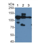 Western blot analysis of (1) Mouse Kidney lysate, (2) Mouse Testis lysate, (3) Mouse Heart lysate, using Rabbit Anti-Mouse ACE2 Antibody (0.5 µg/ml) and HRP-conjugated Goat Anti-Rabbit antibody (<a href="https://www.abbexa.com/index.php?route=product/search&amp;search=abx400043" target="_blank">abx400043</a>, 0.2 µg/ml).