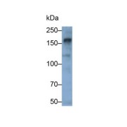 Western blot analysis of HeLa cell lysate, using Rabbit Anti-Human ANLN Antibody (0.2 µg/ml) and HRP-conjugated Goat Anti-Rabbit antibody (<a href="https://www.abbexa.com/index.php?route=product/search&amp;search=abx400043" target="_blank">abx400043</a>, 0.2 µg/ml).